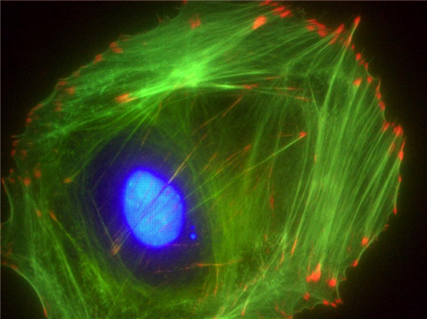 Swiss 3T3细胞anti-vinculin(红色)，DAPI(蓝色)和F-actin(鬼笔环肽)