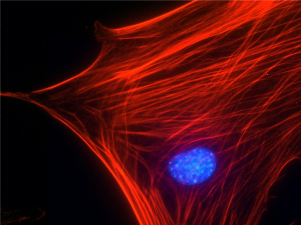 Swiss 3T3 细胞肌动蛋白应激纤维染色（鬼笔环肽）