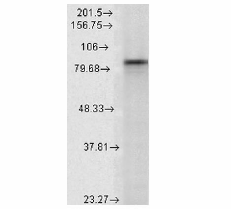 Western-blot-1.png